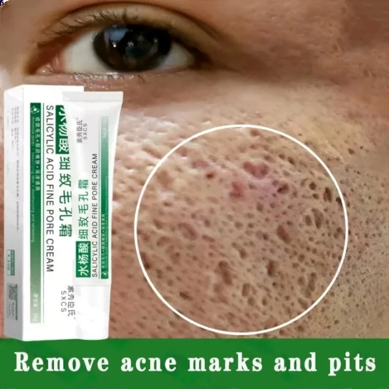 Collagen Peptide Powder - サリチル酸毛穴クリアリングクリーム毛穴を縮小黒ずみ除去にきび明るく保湿スムーズなスキンケア韓国製品
