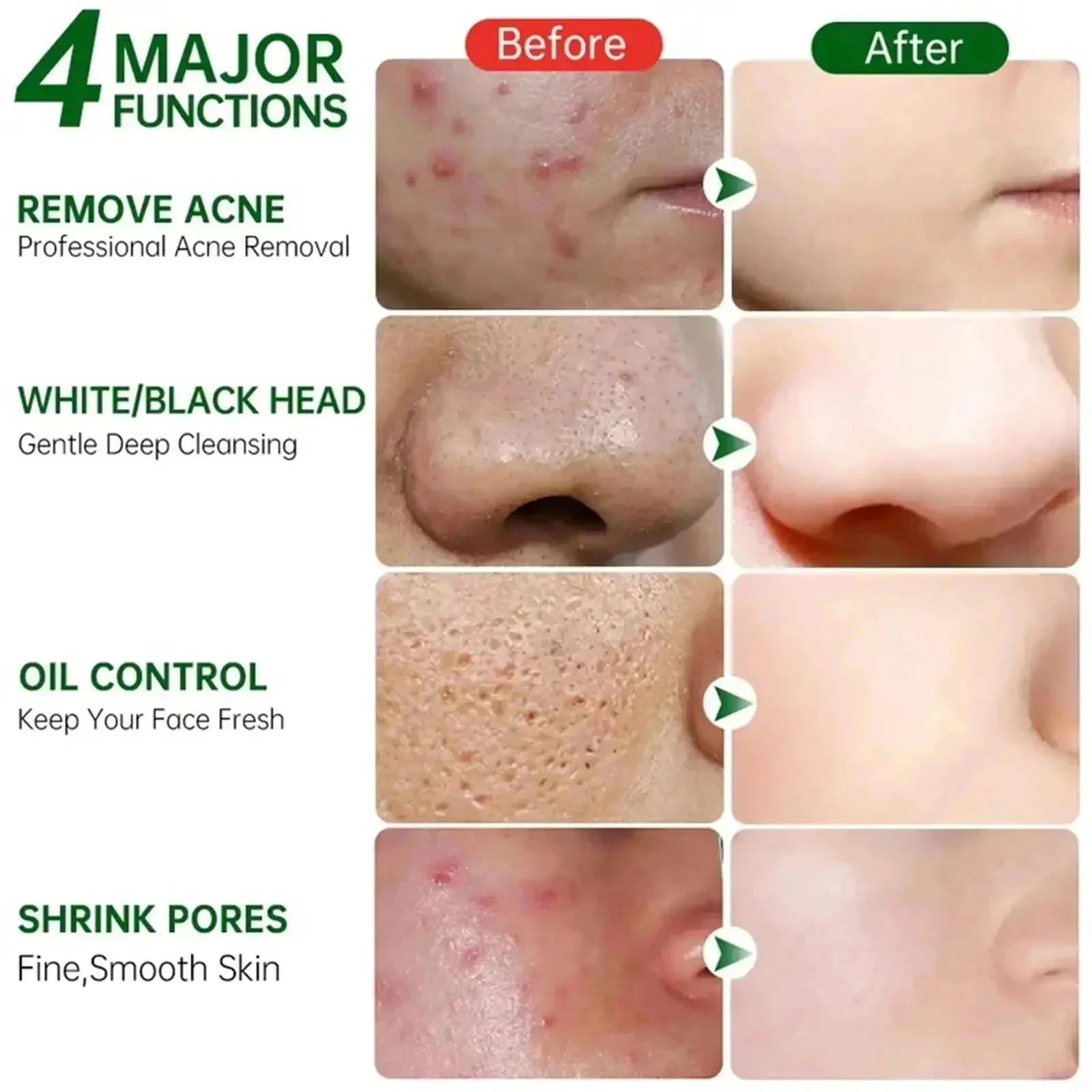 サリチル酸毛穴クリアリングクリーム毛穴を縮小黒ずみ除去にきび - Collagen Peptide Powder のレビューと価格