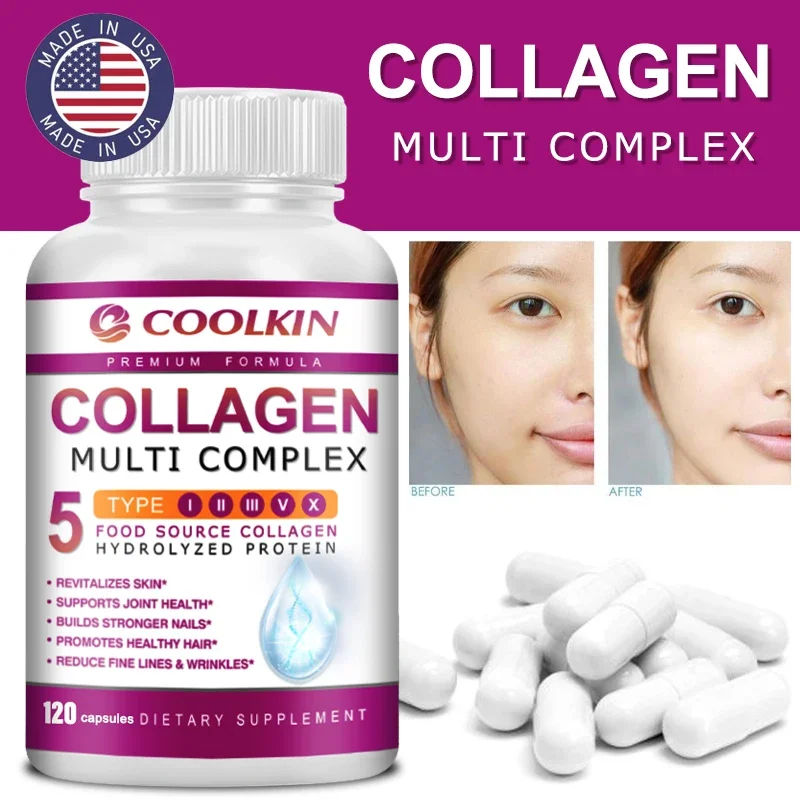 コラーゲンマルチコンプレックス - タイプI、II、III、 - Collagen Peptide Powder のレビューと価格