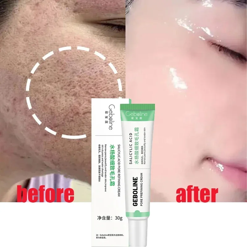 Salicylicalpore-縮小クリーム,フェイシャルビ - Collagen Peptide Powder のレビューと価格