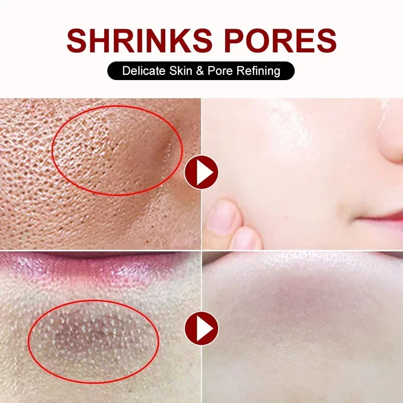 Salicylicalpore-縮小クリーム,フェイシャルビ - Collagen Peptide Powder のレビューと価格